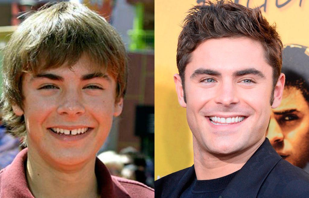 famosos-con-diastemas-Efron