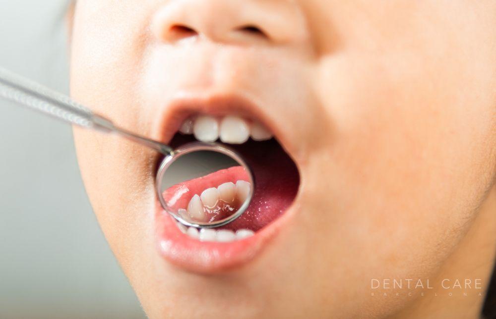 Cuidados importantes para los dientes de leche